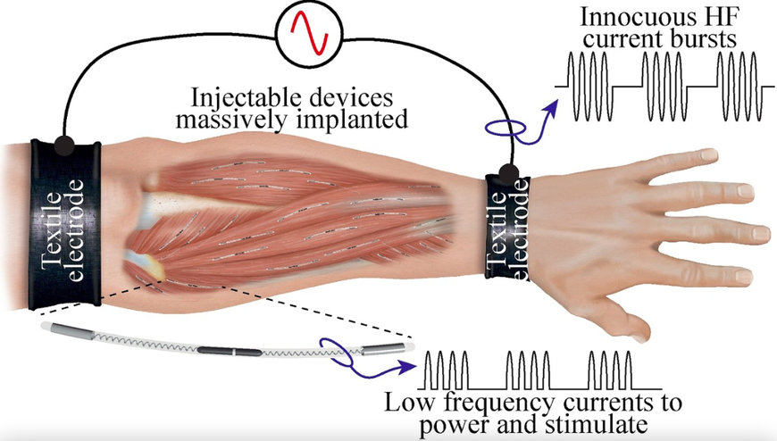FRAUNHOFER DEVELOPS HUMAN-MACHINE INTERFACE THAT STOPS MUSCLE TREMORS